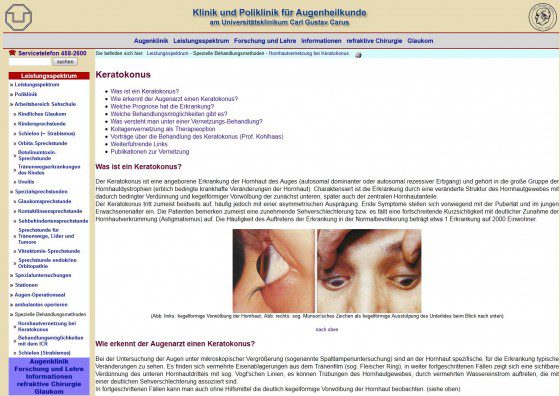 Keratokonus heilen: Symptome, Stadien, Operation (Screenshot http://augen.uniklinikum-dresden.de/seite.asp?ID=104 am 06.03.2013)